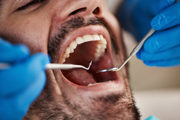 Best Urgent Dental Care for Toothache in Cape Charles, VA